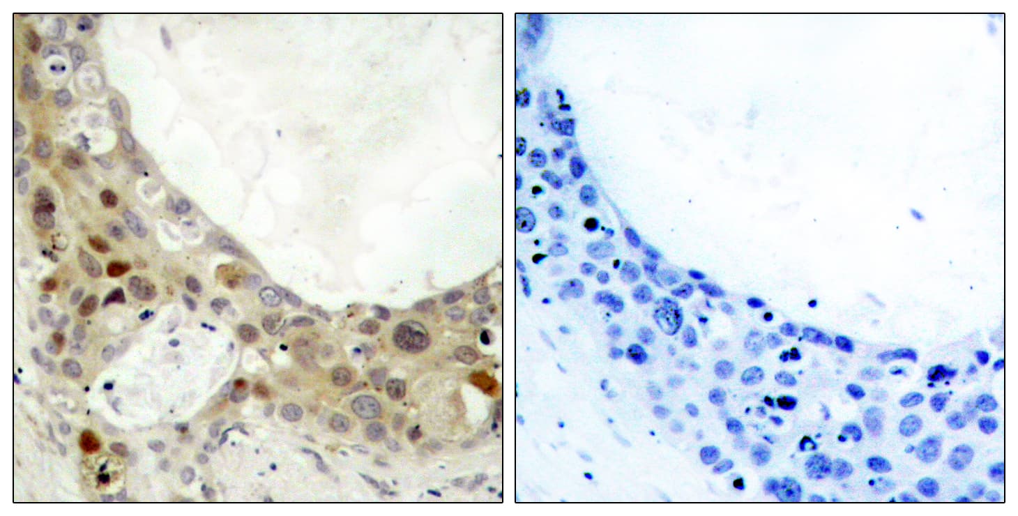BCL2 / Bcl-2 Antibody (phospho-Ser70)