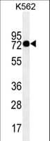 TGM2 / Transglutaminase 2 Antibody