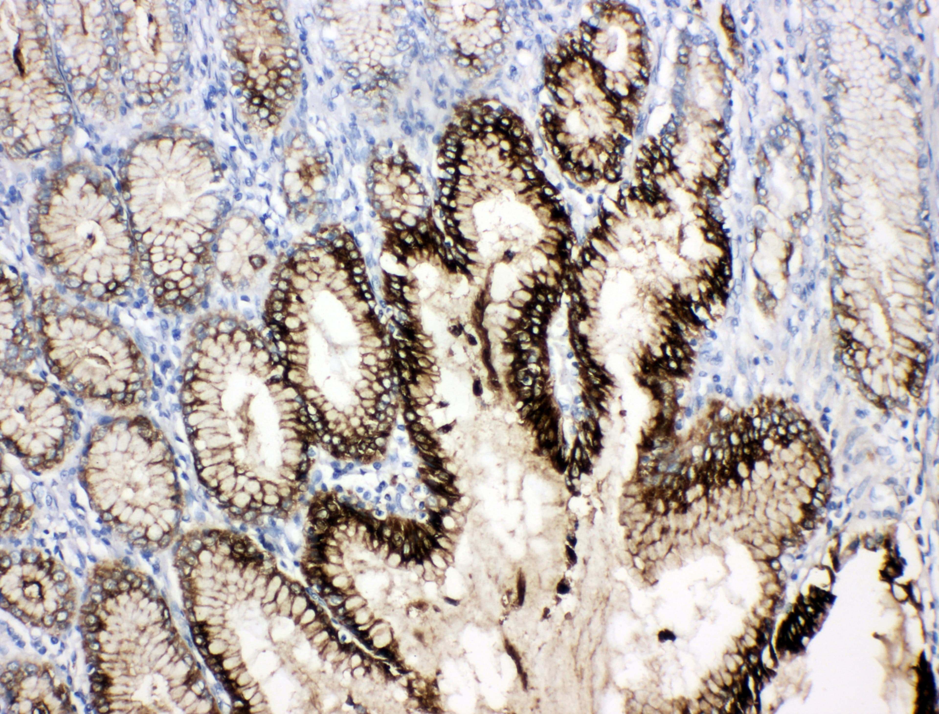 TFF1 / pS2 Antibody (aa67-84)
