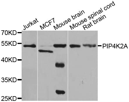 Polyclonal Rabbit anti-Human PIP4K2A / PIPK Antibody (IHC, IF, WB)
