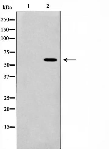 Polyclonal Rabbit anti-Human PSEN1 / Presenilin 1 Antibody (IHC, IF, WB)