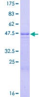 Human CCN5 Protein (Recombinant GST)