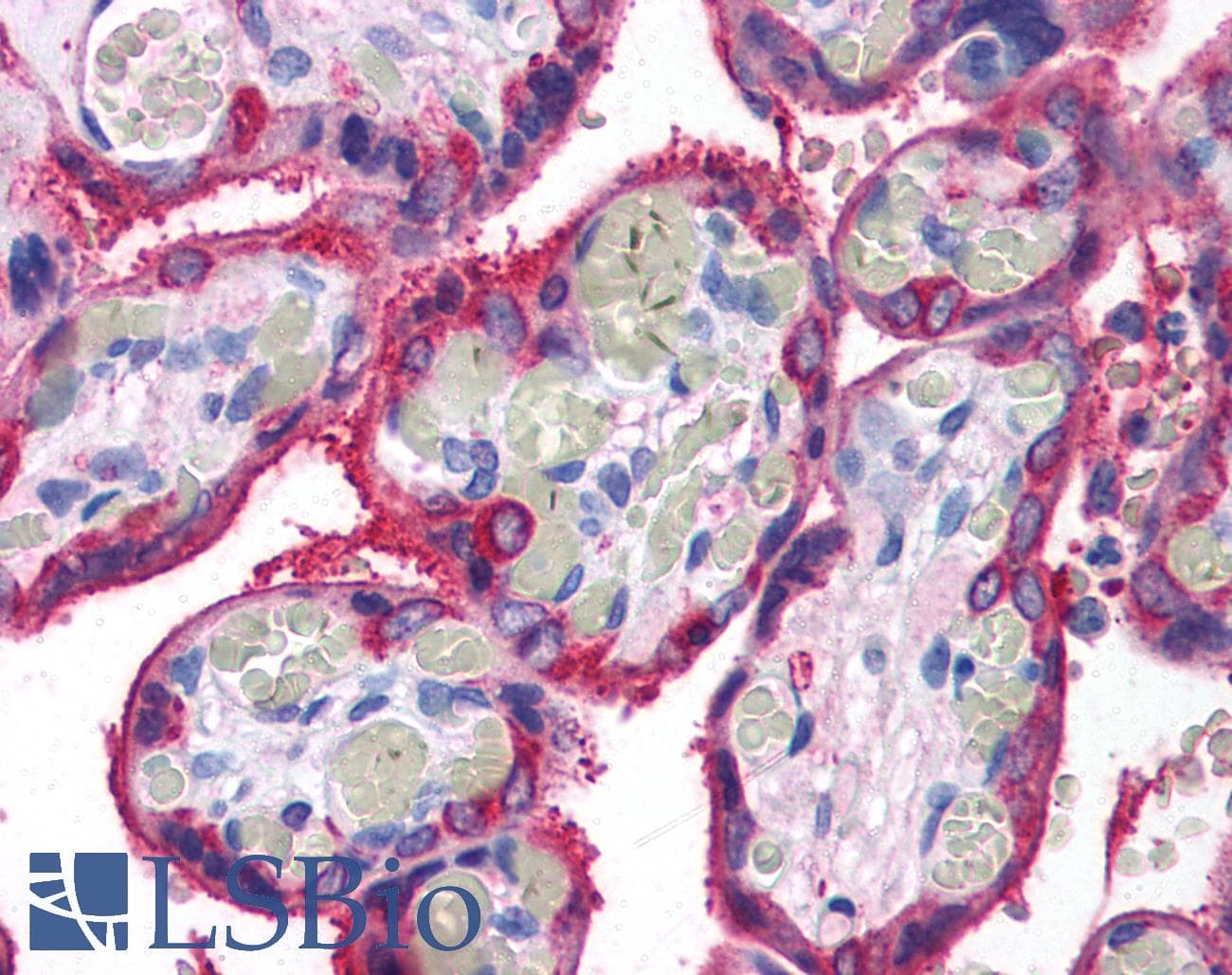 IHC-plus™ TGM2 / Transglutaminase 2 Antibody