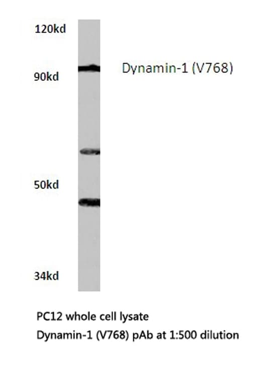 Polyclonal Rabbit anti-Human DNM1 / Dynamin Antibody (Val768, IHC, WB)