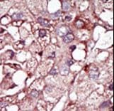 ACVRL1 Antibody (aa38-68)