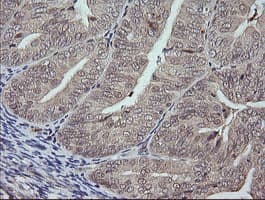 MAPK9 / JNK2 Antibody (clone OTI1A1)