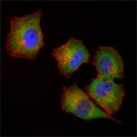 NME1 / NM23 Antibody (clone 4B2)