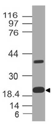 FTL / Ferritin Light Chain Antibody