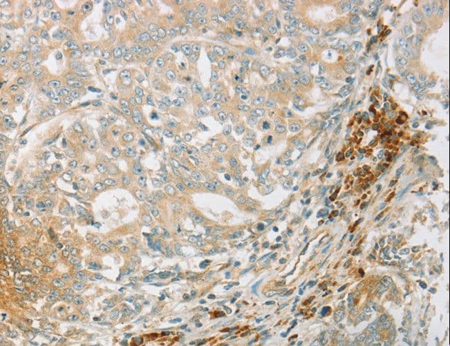 PRKAA1 / AMPK Alpha 1 Antibody
