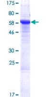 Human SUSD6 / KIAA0247 Protein (Recombinant GST)