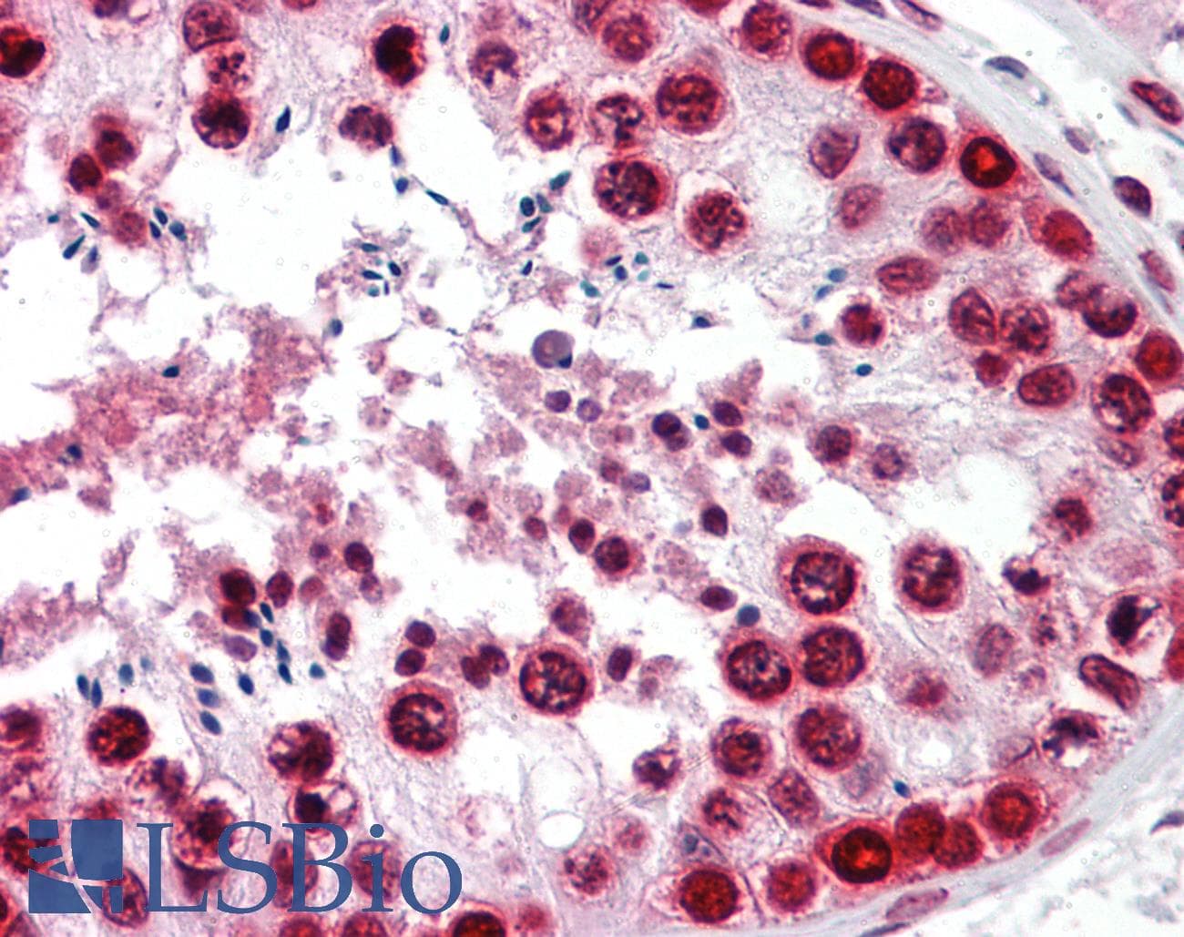 IHC-plus™ BANF1 / BAF / BCRP1 Antibody (clone 3F10-4G12)