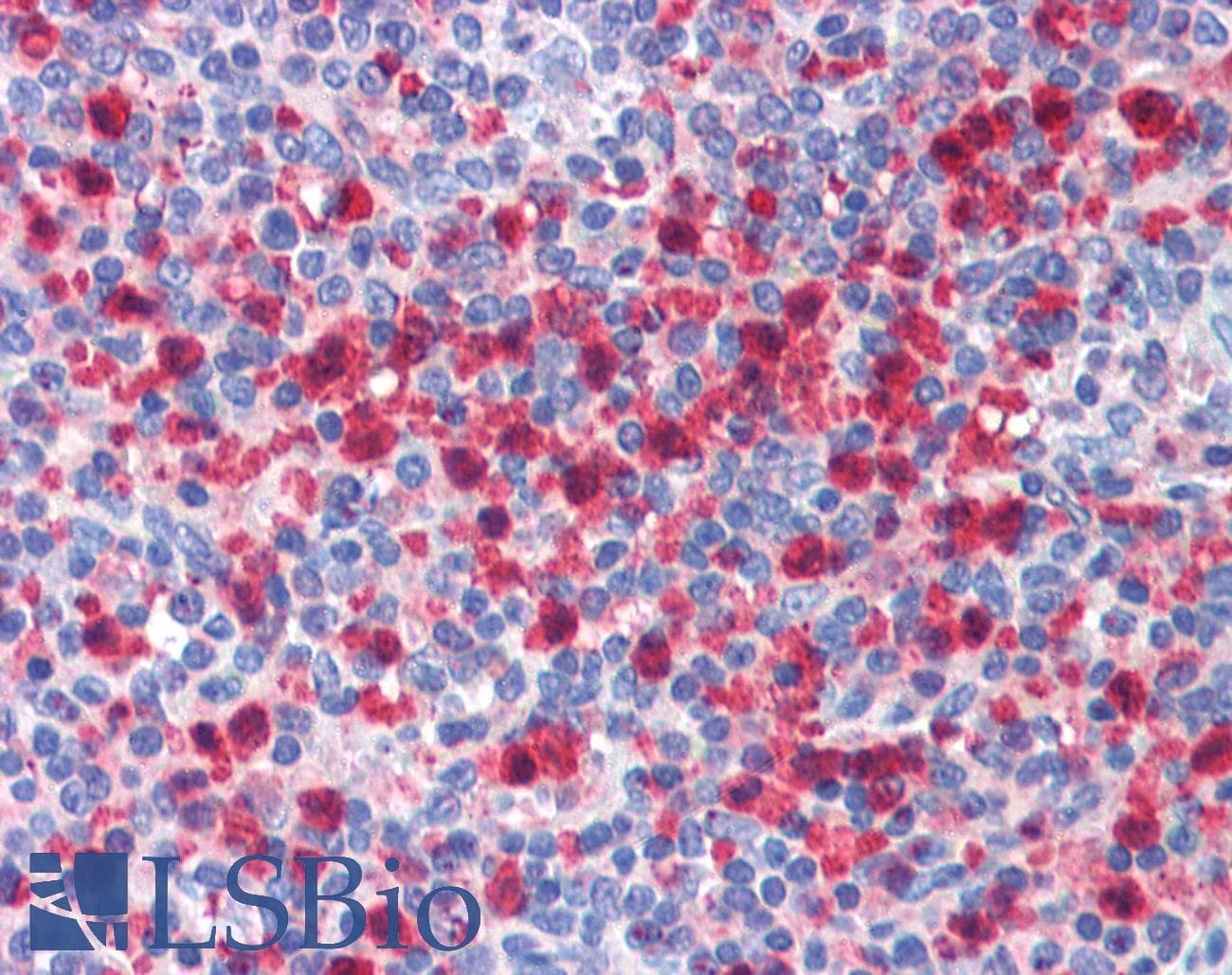 PBRM1 / BAF180 / PB1 Antibody (aa1511-1560)