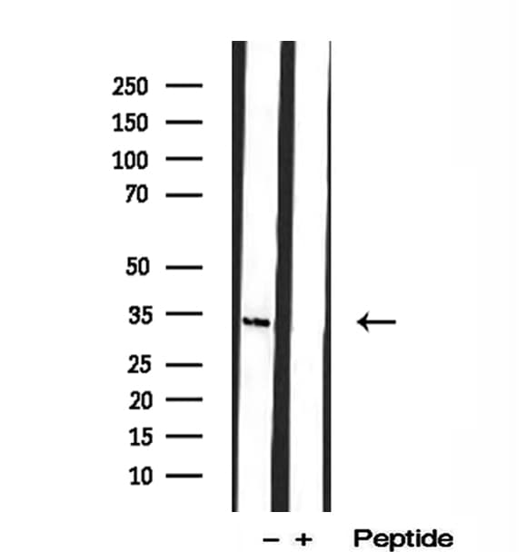HEY1 Antibody