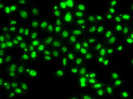 SETBP1 / SEB Antibody