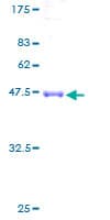 Human CINP Protein (Recombinant GST)