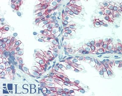 CTNNB1 / Beta Catenin Antibody (clone OTI1E10, Carrier-free)