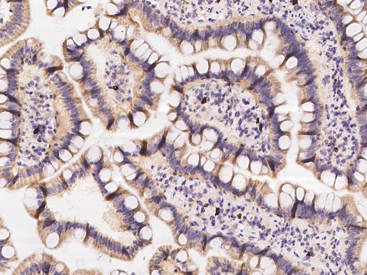 ZNF576 Antibody