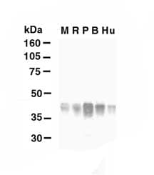 IHC-plus™ GLUL / Glutamine Synthetase Antibody