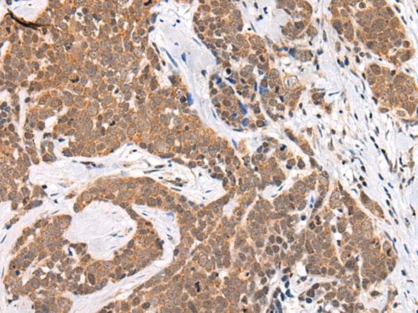Polyclonal Rabbit anti-Human C13orf8 / ZNF828 Antibody (IHC)