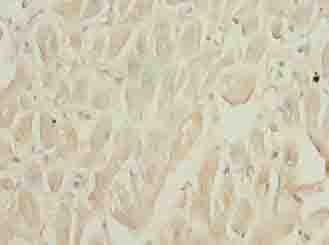 SEPW1 / Selenoprotein W Antibody