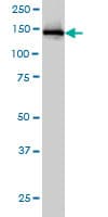 IKBKAP / IKAP Antibody (clone 6G9)