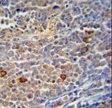 TRMO / C9orf156 Antibody (aa365-391)