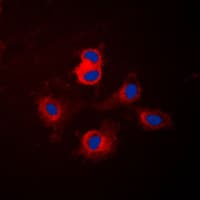 CYP17 / CYP17A1 Antibody (Internal)