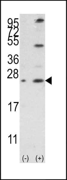 Polyclonal Rabbit anti-Human BCL2L2 / Bcl-w Antibody (aa24-59, IHC, WB)