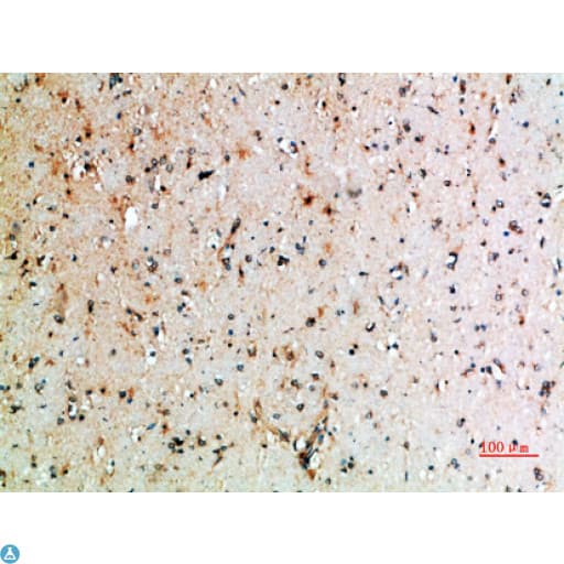 Polyclonal Rabbit anti-Human CTLA4 / CD152 Antibody (IHC)