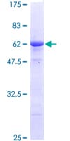 Human STC2 / Stanniocalcin 2 Protein (Recombinant GST)