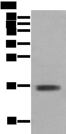 TNNC1 / Cardiac Troponin C Antibody