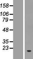 ZNF593 Protein (Over-Expression Lysate Myc-DDK (Flag))