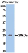 APOB / Apolipoprotein B Antibody (aa3360-3526, Biotin)