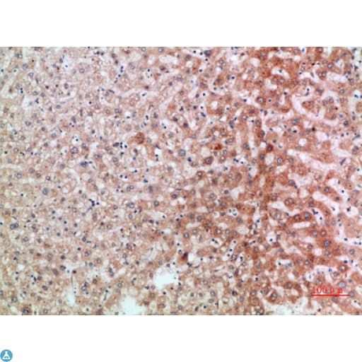 IL1RL1 Antibody