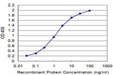 IHC-plus™ SSX2 Antibody (clone 1A4)