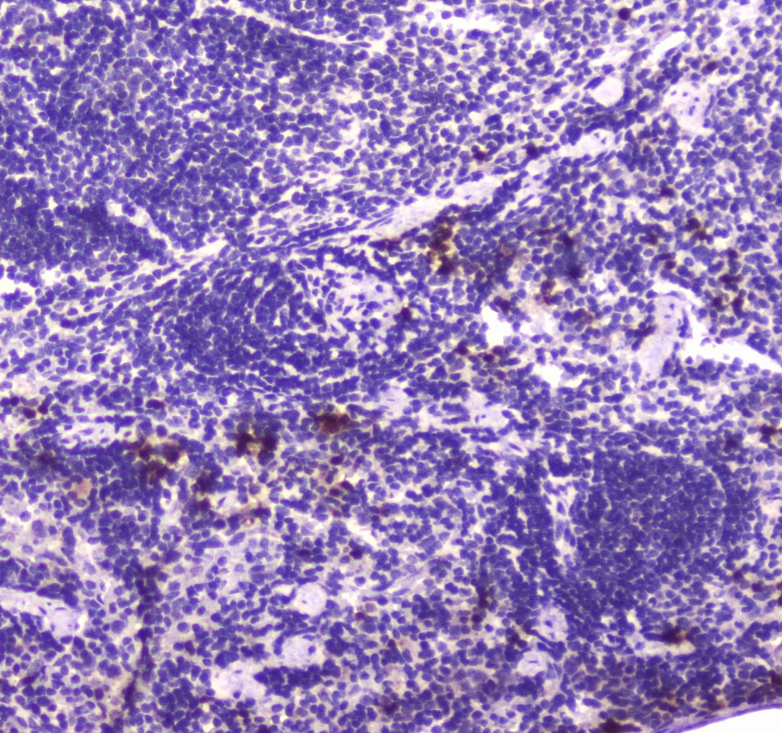 Polyclonal Rabbit anti-Human LF / LTF / Lactoferrin Antibody (IHC, WB)