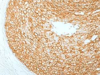 ERBB2 / HER2 Antibody (clone ERBB2/2453)