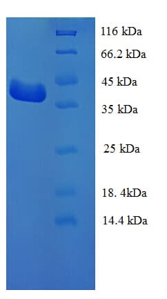 Human TRIP / LRRFIP1 Protein (Recombinant His)