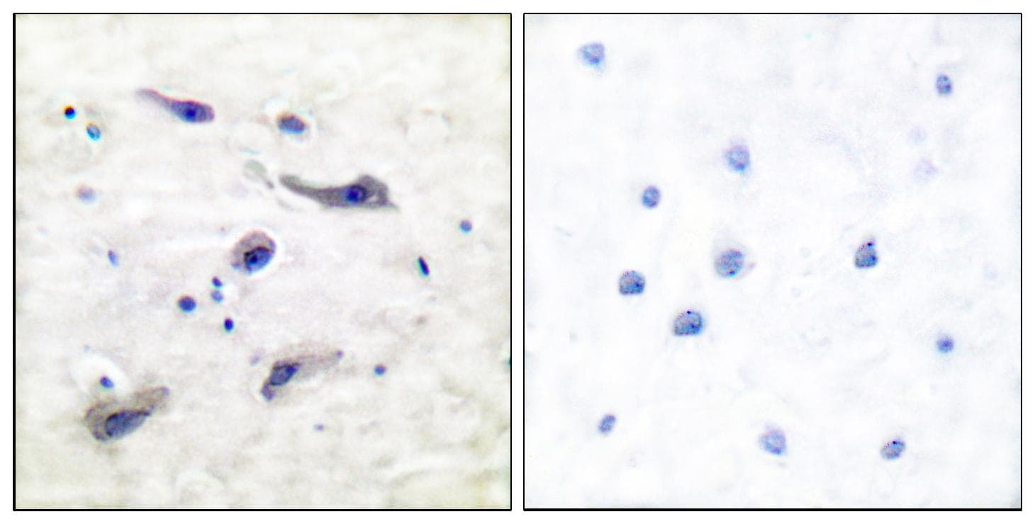 Polyclonal Rabbit anti-Human MTOR Antibody (phospho-Ser2448, IHC, WB)