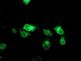 TPSG1 / Tryptase Gamma 1 Antibody (aa20-283, clone OTI2A10)