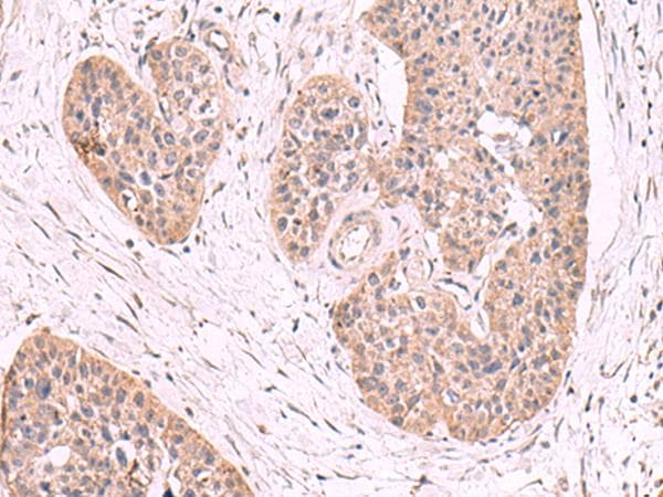 MGP / Matrix Gla-Protein Antibody