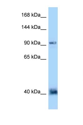 Polyclonal Rabbit anti-Human DACT1 / DAPPER Antibody (aa139-188, WB)