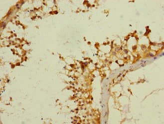ANKS1B Antibody