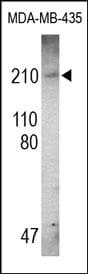 Polyclonal Rabbit anti-Human BRCA1 Antibody (WB)