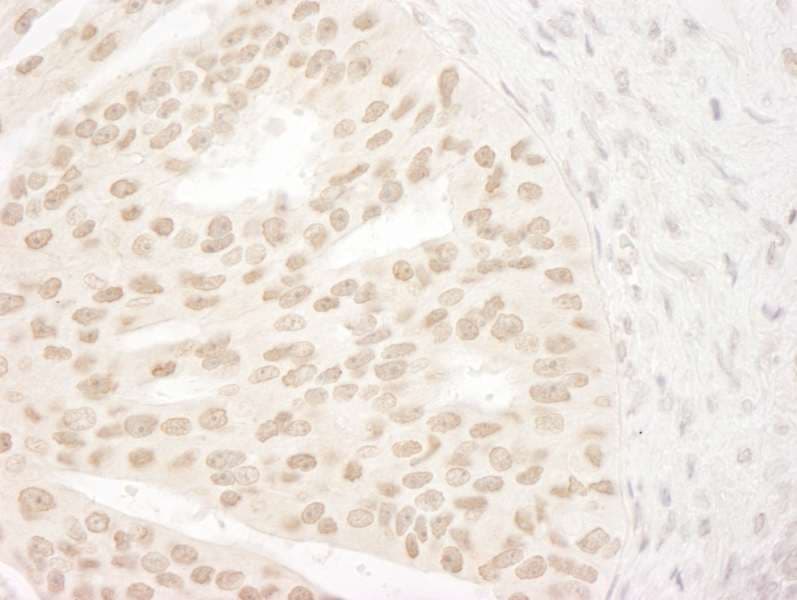 Polyclonal Rabbit anti-Human ANKRD28 Antibody (aa975-1025, IHC, WB)