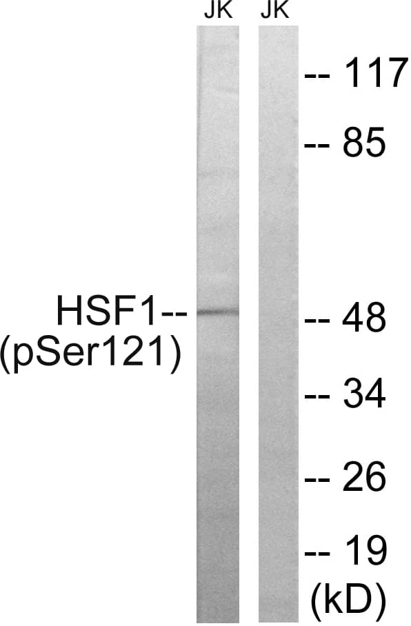 HSF1 Antibody (phospho-Ser121)
