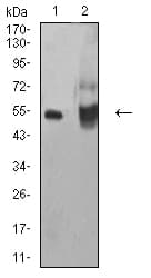 ALDH1A1 / ALDH1 Antibody (clone 2G1G4)