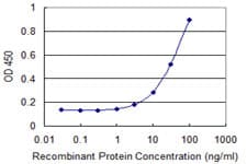 RPS8 / Ribosomal Protein S8 Antibody (clone 4D11)