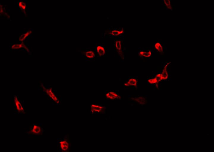 RACGAP1 / MGCRACGAP Antibody