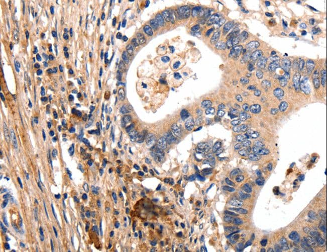 Polyclonal Rabbit anti-Human GSK3A / GSK3 Alpha Antibody (IHC)